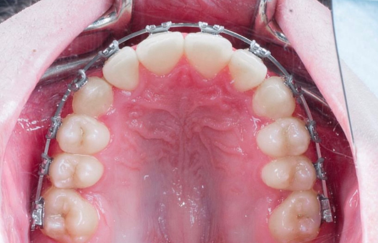 После лечения