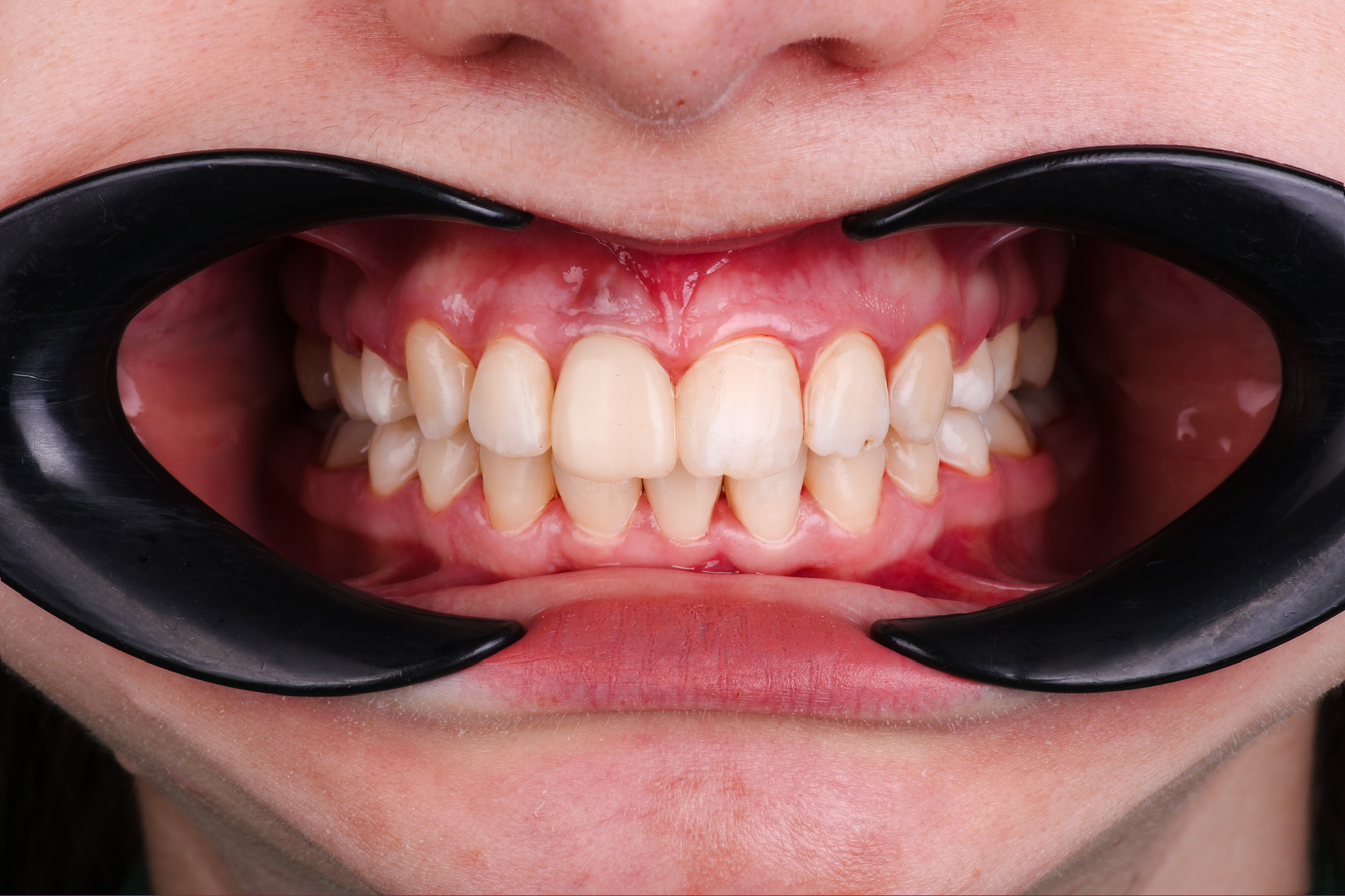 После лечения